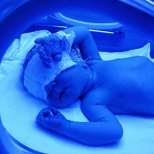 Fototerapia Domiciliar